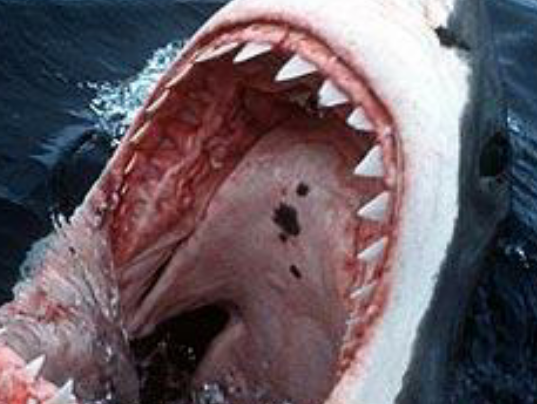 Understanding & Managing Pain Post Op!