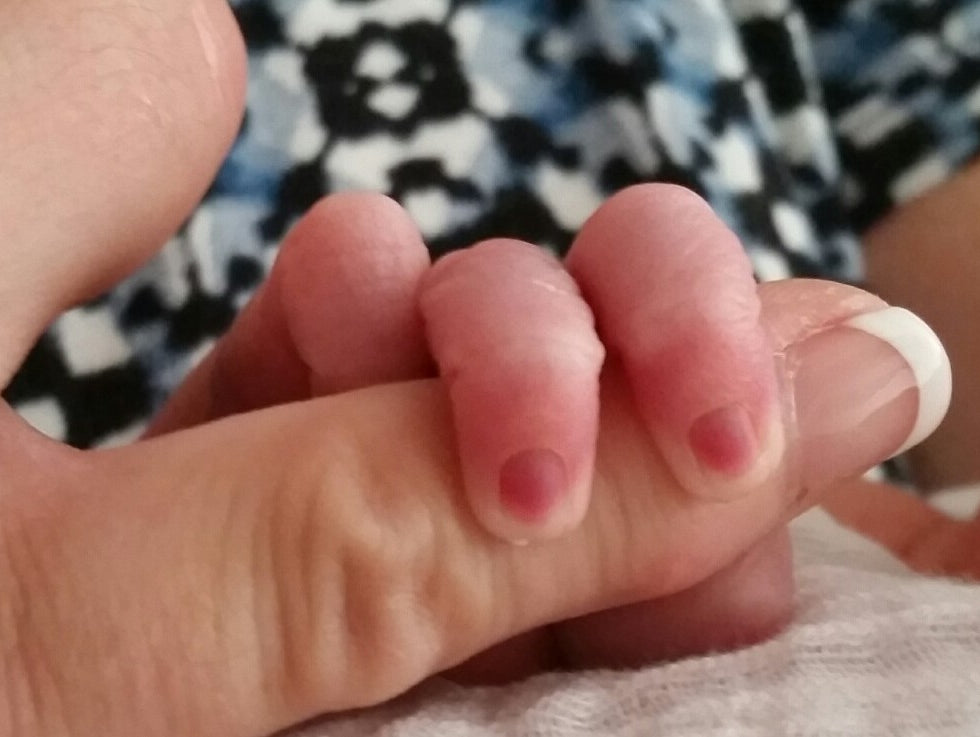 Training Without Purpose, And Then This Happened !