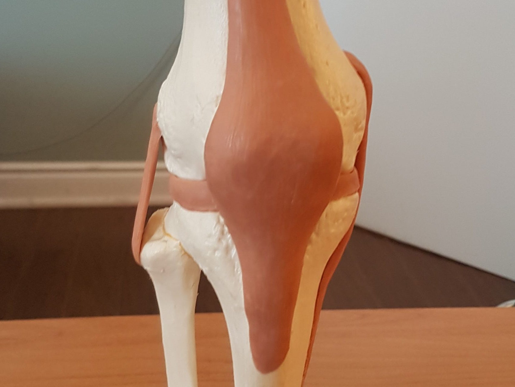 MRI, Ultrasound & X-Ray Results!
