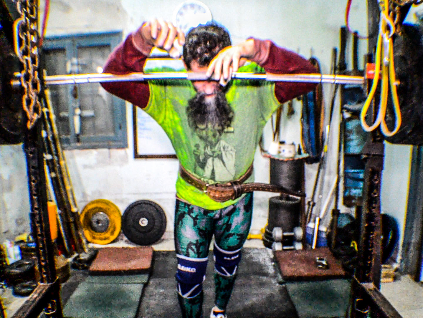 Mega Supplements for Recovery?