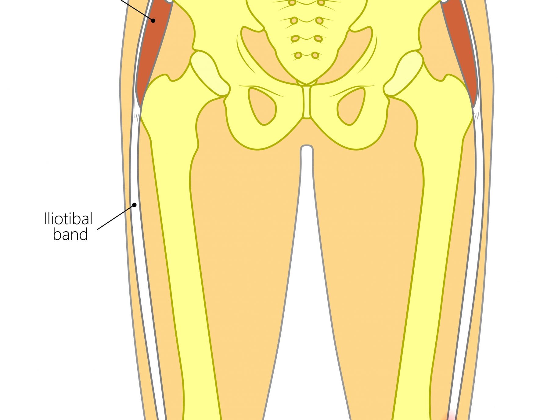Temporarily Alleviate or Troubleshoot HIP SHIFT