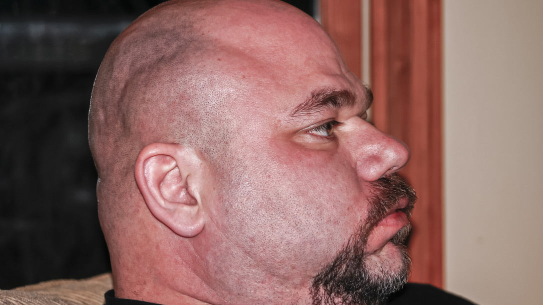 dave bloat