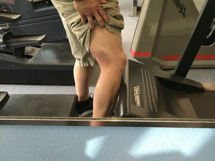 3/31- Pop goes the hamstring