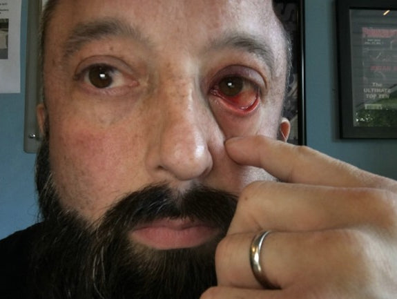 5/5- An Upper Respiratory infection, Poop eye and Squat Openers w/Team Video, 4 weeks out from the APF Equipped Nationals