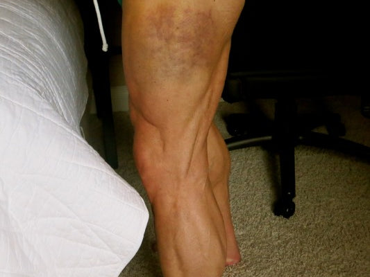 Ka-POW That hamstring hasn't sounded like that in YEARS!