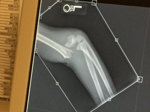 The day I backed out of a competition...