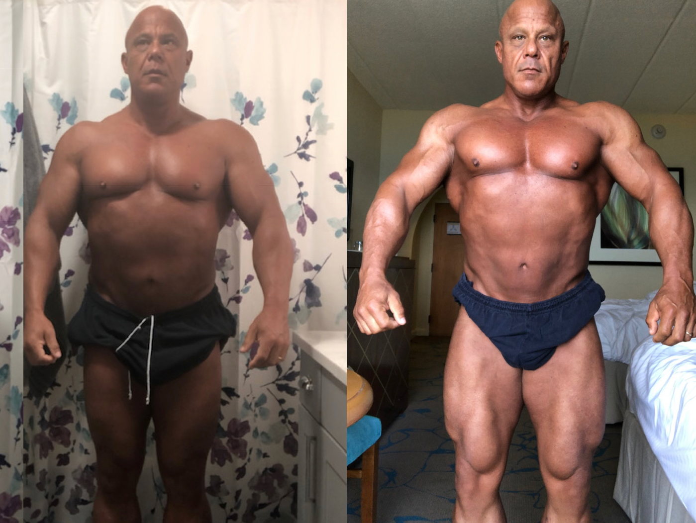 The Fat-Guy Bum-Knee Diet