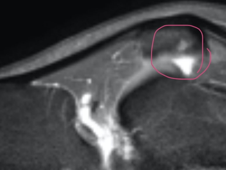 Skip? Men's Physique‽