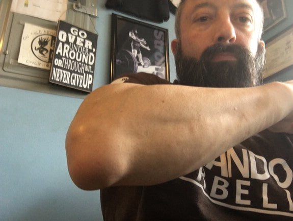 2/22- Accessory work and swollen joints