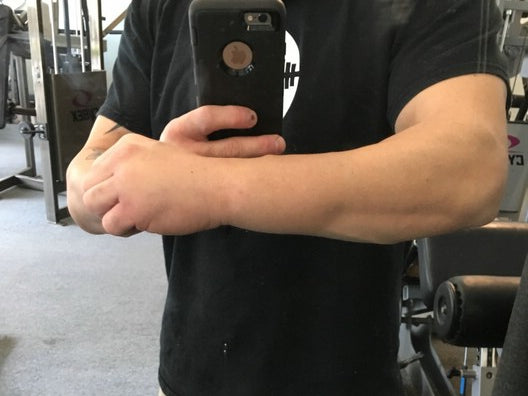 3/8- This bench training session is brought to you by my right swollen forearm
