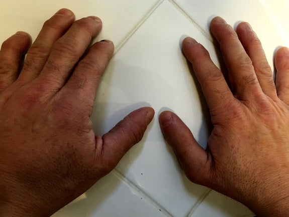 An attempt to find a cure for my autoimmune issues