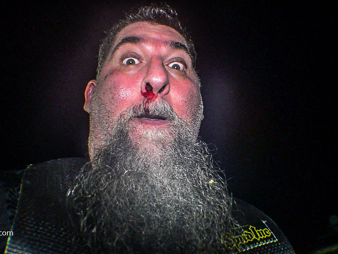 Super Yoke PR with NOSEBLEED VIDEO