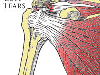 Signs & Symptoms Of Injury Not To Be Ignored.