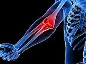 Solution to elbow issues