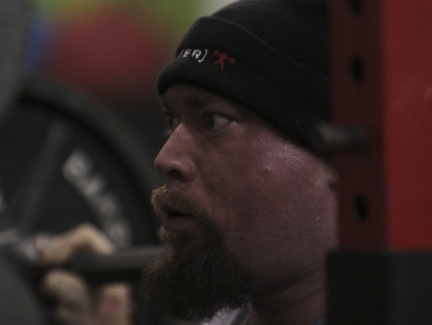 Surgery update and pride