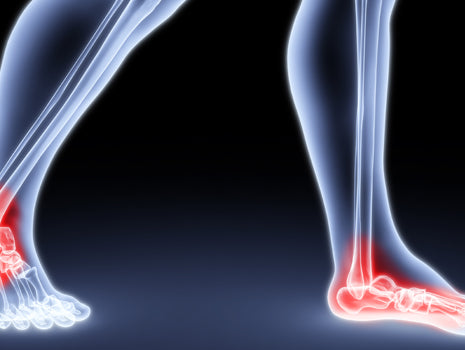 Feet For Hip Position On Deadlifts