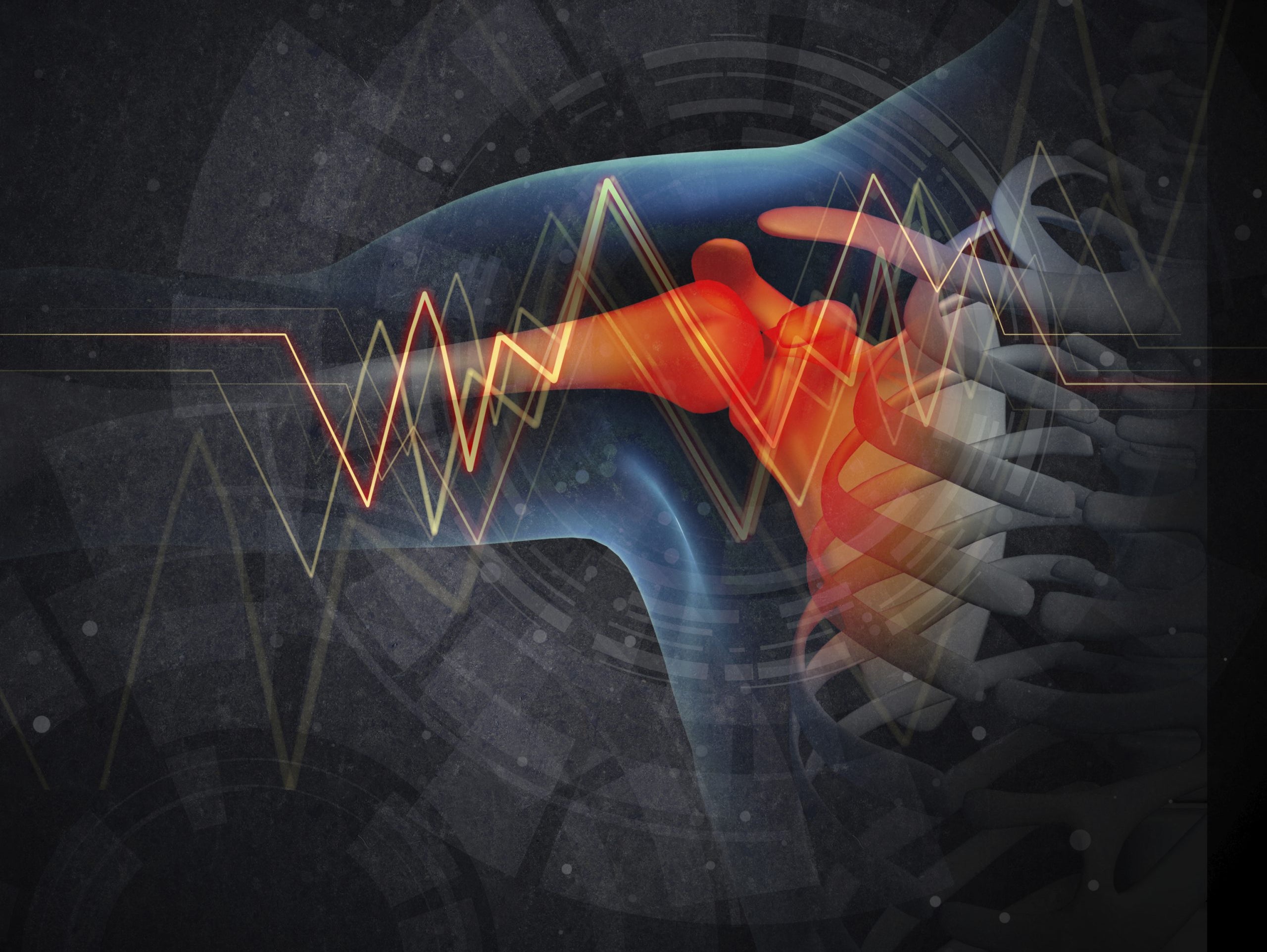 7/29 Speed bench & Best shoulder prehab exercise?