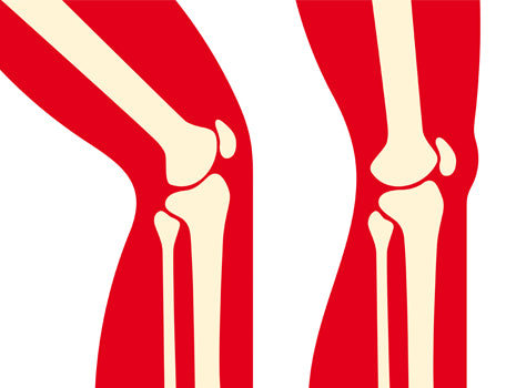 The Post-Surgical Knee: The Range of Motion Rebuild