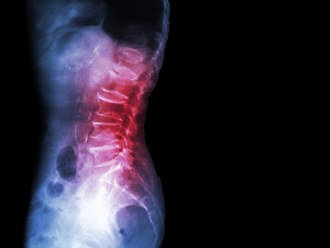 How to Relieve Lower Back Pain