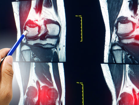 How to Come Back From Multiple Injuries