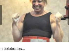 Surgeon Says Lift Away, 3 Months Post Surgery!