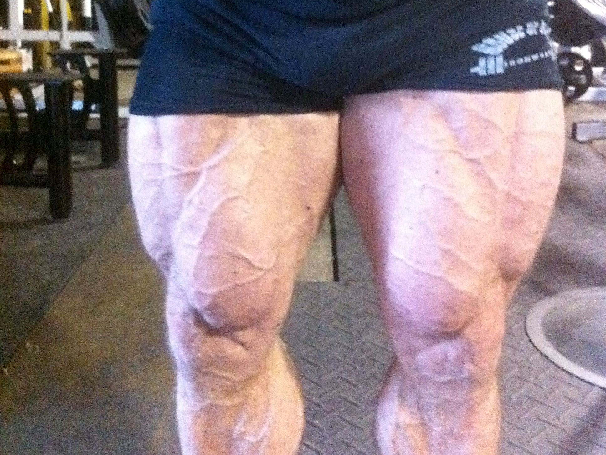 Another BRUTAL Leg Session Caught on Video