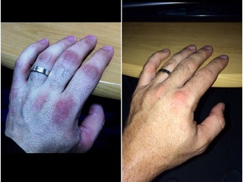 Starting Off On The Wrong Foot!