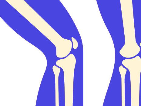 The Post-Surgical Knee: The Stability and Proprioception Rebuild