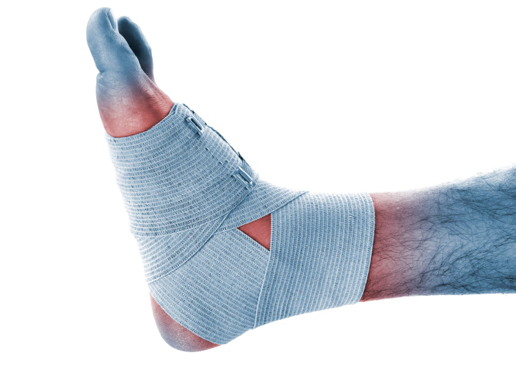 Alleviating Ailing Ankles