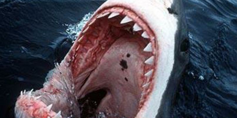 Understanding &amp; Managing Pain Post Op!