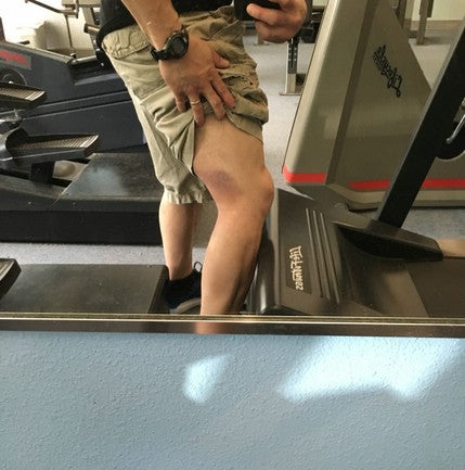 3/31- Pop goes the hamstring