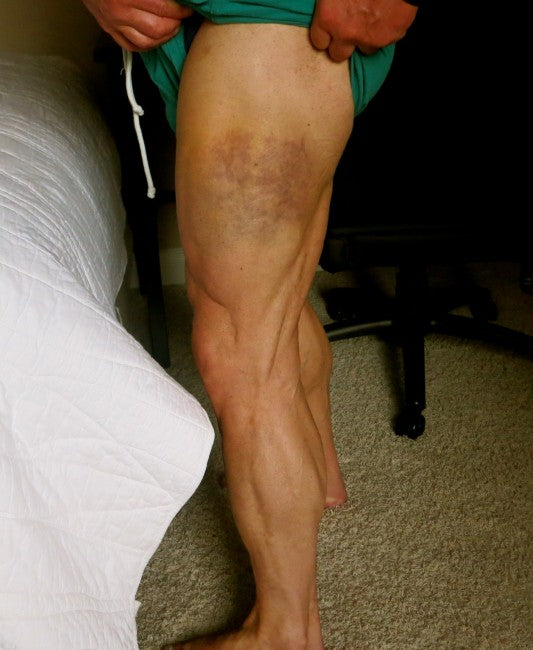 Ka-POW  That hamstring hasn't sounded like that in YEARS!