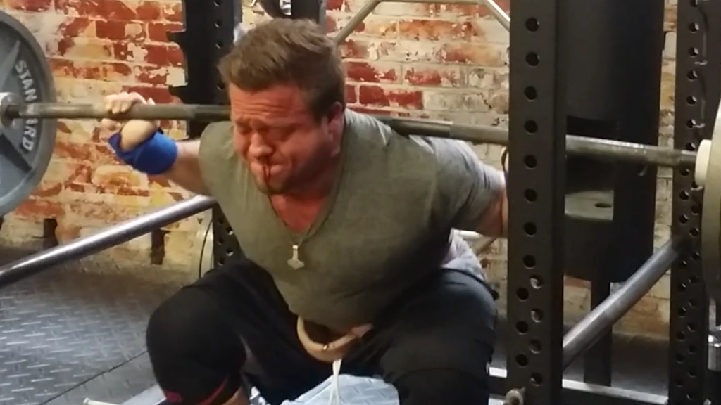 I've Sprung A Leak!!! 655x6 Squat PR and Nosebleed!
