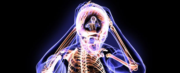 C&amp;C log # 5: HEAD &amp; SHOULDERS.....dandruff free