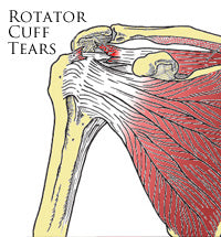 Signs &amp; Symptoms Of Injury Not To Be Ignored.