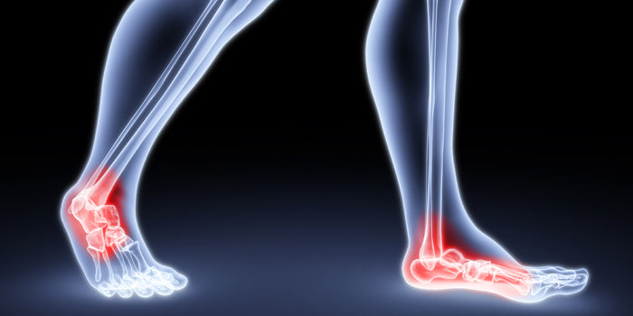 Feet For Hip Position On Deadlifts