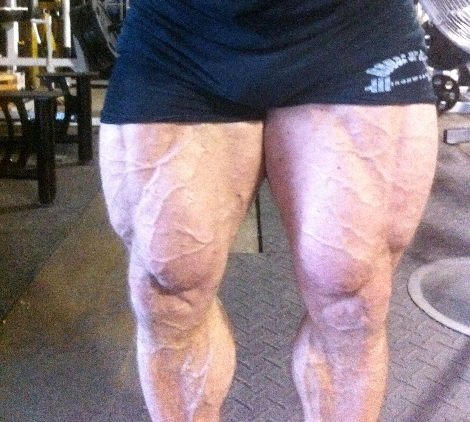 Another BRUTAL Leg Session Caught on Video