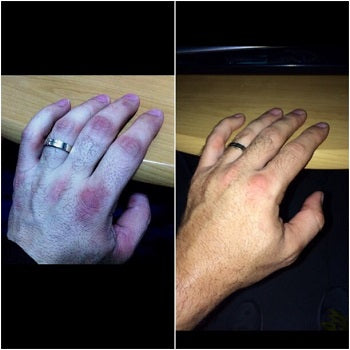 1 Year of Chemo