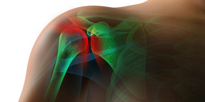 X-BAND SHOULDER CLEAN