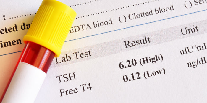 Your “Other T” Levels