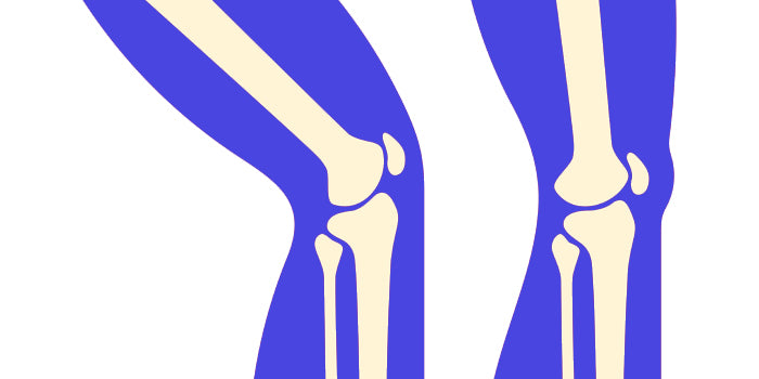 The Post-Surgical Knee: The Stability and Proprioception Rebuild