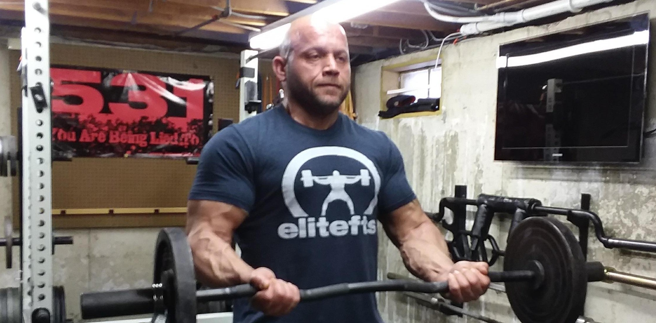 Battling Elbow Tendinitis