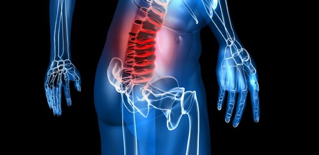 How to End Back Pain Now - Elite Sports Clubs